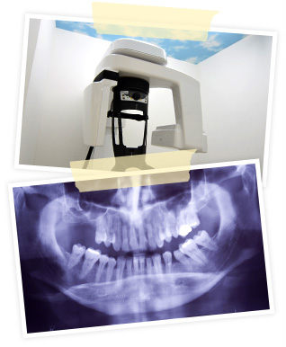 歯科用CT